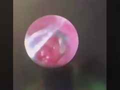 Πυροσβεστική χειρουργική